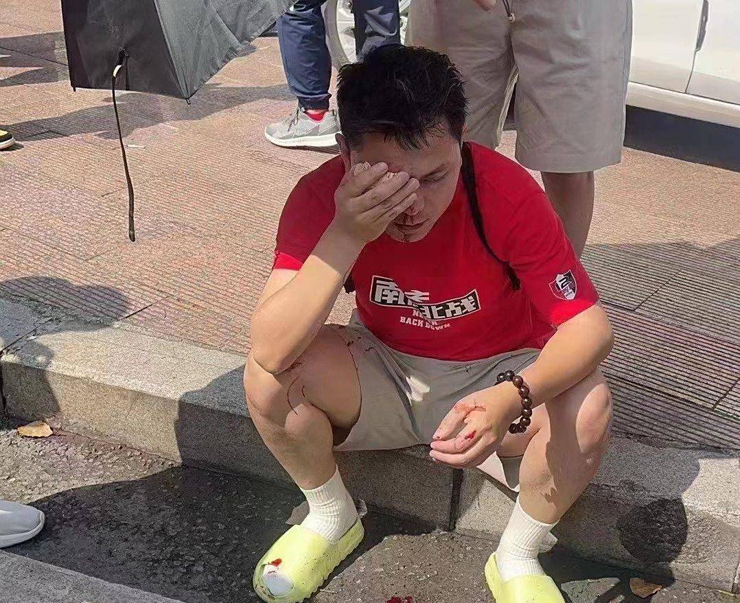 Ning与70激战德国队分钟，败北胜负难料！，东契奇焦点对战上演精彩一战的简单介绍